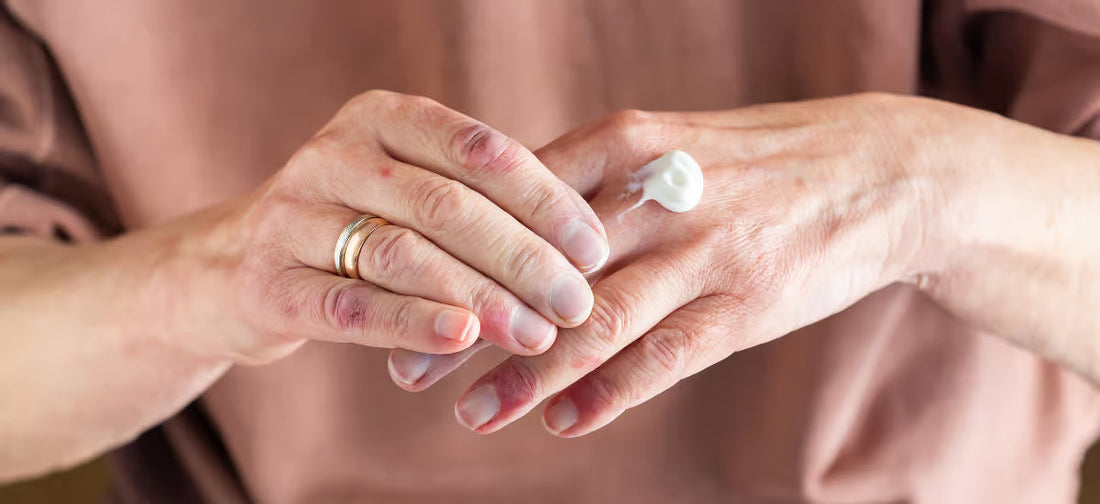 Hände mit aufgetragener Creme