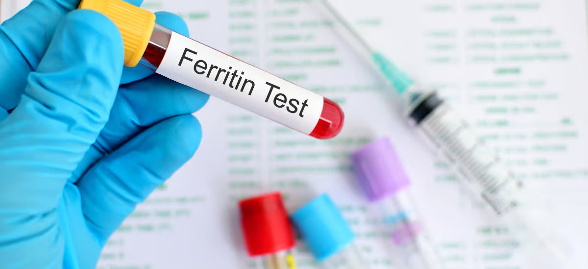 Das Foto zeigt eine Hand mit einem Test für den Ferritinwert.