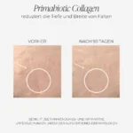 collagen