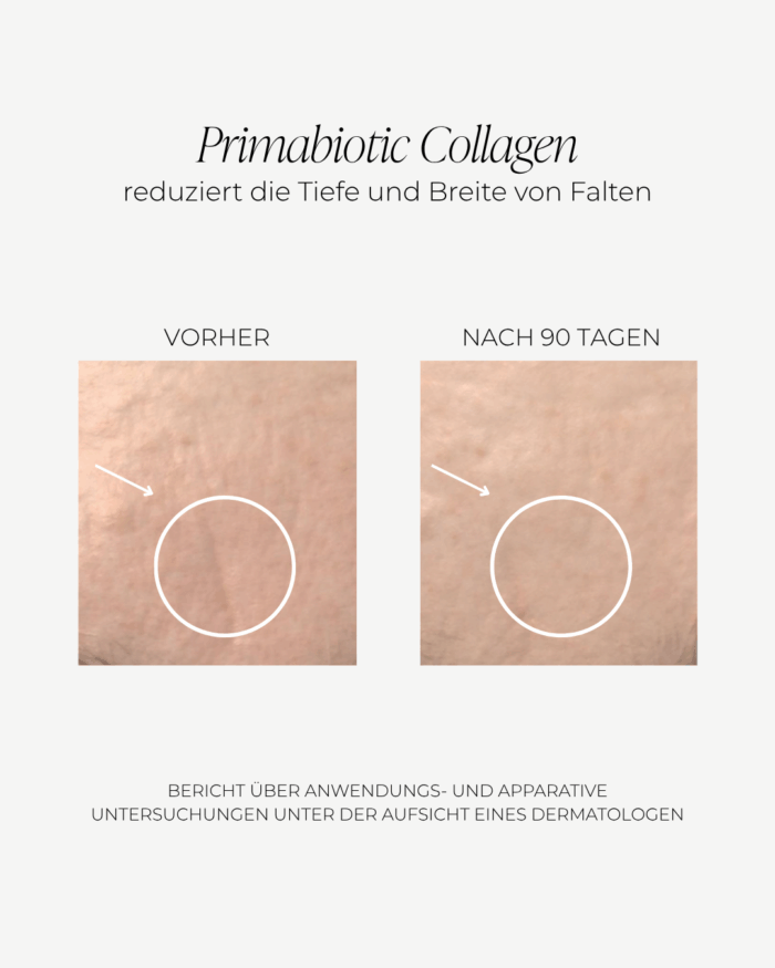 collagen